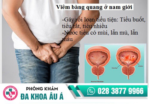 Viêm bàng quang