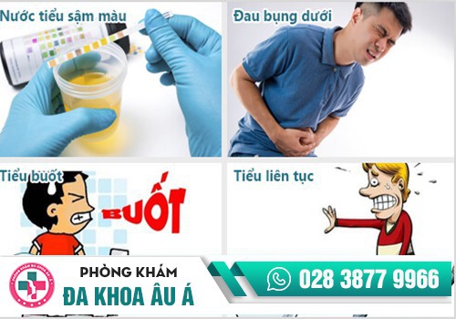 KHI NÀO NÊN ĐI KHÁM VIÊM ĐƯỜNG TIẾT NIỆU?